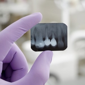 radiologia dental gessal