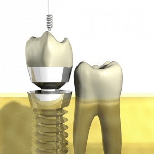 Ortodoncia, reconstrucciones, rehabilitaciones gessal